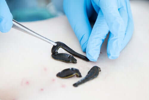 医療用のヒルを研究する人